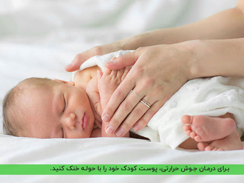 خنک کردن پوست نوزاد با حوله خنک برای درمان جوش حرارتی