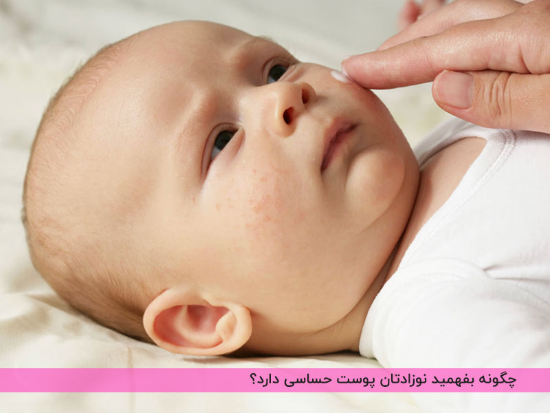 علائم وجود حساسیت در پوست نوزاد